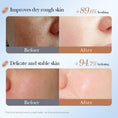 Load image into Gallery viewer, Nourishing Coconut Oil Face Mask 25g Moisturizing Hydrating Skin Care Facial Treatment Patch
